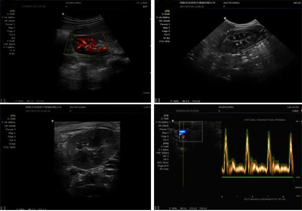 4d Ultrasound Machine Portable Ultrasound Scanner With 3D And Phased Array Probe Optional