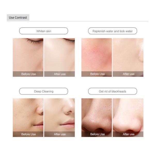 Hydra Facial H2O2 Bubble Machine Hydrogen Oxygen Spray Skin Peeling 8 In 1 Machine