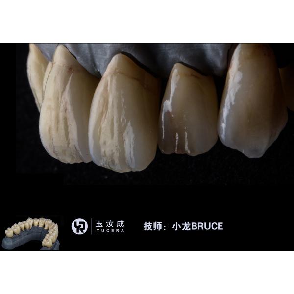 A1 A2 3D 1050MPA Dental Zirconia Block For Laboratorio Dental