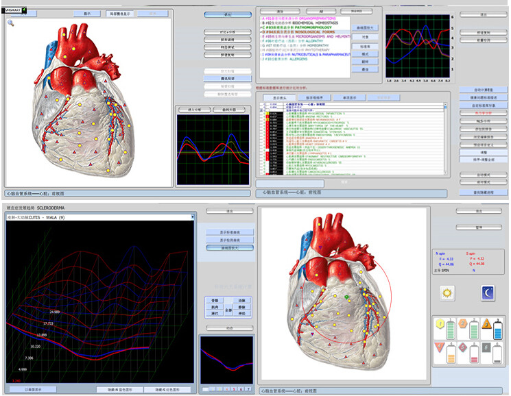 Magnatic Resonance 9D Nls Health Analyzer Non Linear Body Diagnostic System