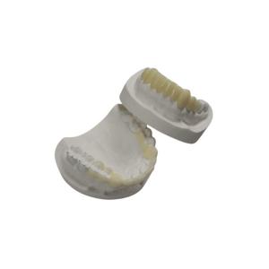 China Custom TEMP Porcelain Tooth Crown Inlay Onlay Strong Hardness Veneer on sale