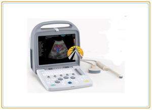 China Smart Ultrasound Scan Machine Portable Color Doppler Fashionable Design on sale