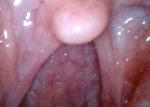 Android / Ios / Windows Wireless Intraoral Camera