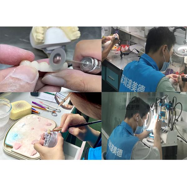 Staining Resistance Solid Zirconia Crown for front teeth posterior teeth