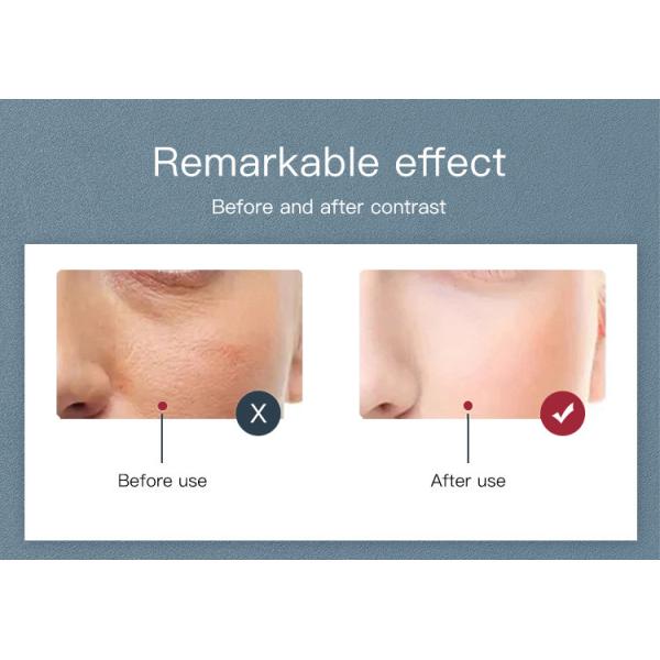 Professional Photon 7 Colors PDT Led Light LED Facial Mask Machine For Skin Rejuvenation Light Therapy