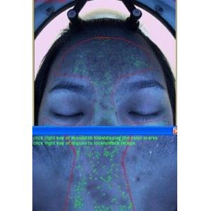 Wholesale RGB Moisture Skin Analyzer Machine , Moisture Analysis with 3D Function from china suppliers