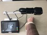 No Radiation Clear And Accurate Infrared Vein Finder With 2 Million Pixels