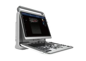 China MSK Portable Ultrasound Scanner Machine With 18 MHz High Frequency Linear Probe on sale