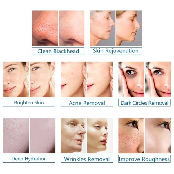 Hydra Facial 6 In 1 Microdermabrasion Machine Pore Cleaning H2O2