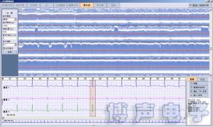 BORSAM PC Based EKG Analyzer Holter ECG Software System