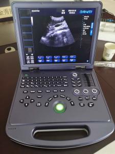 China 2D Portable Ultrasound Machine With PC Platform AV220V 60Hz on sale