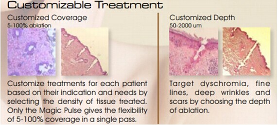 Super Pulse Fractional CO2 Laser Machine For Spot Laser Removal