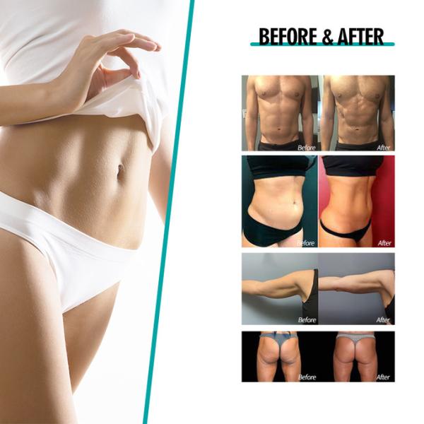 Magshape Body Slimming Ems Sculpting Machine 3000W