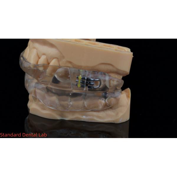 Customizable Dorsal Sleep Appliance Anti Snoring Device For Restful Sleep China Dental Lab
