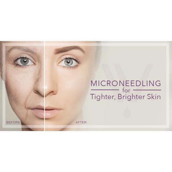 2 In 1 Fractional Rf Microneedle Machine Adjustable Depth Of Needle