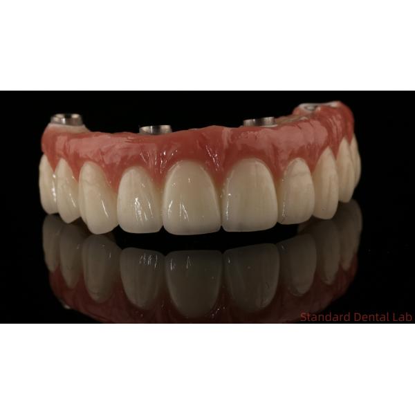 Professional Zirconia Dental Implant Crown Titanium CAD CAM Zirconia Crown China Dental Lab