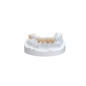Wholesale Inlays Onlays Ceramic Dental Crown Strong Veneer For Dental Department from china suppliers