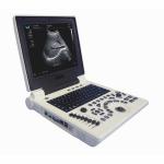 ISO Electron Scan Notebook USG Scan Machine For Obstetrics And Gynecology