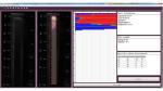 0-200μM Automated Particle Analyzer In Good Reproducibility And Accuracy For