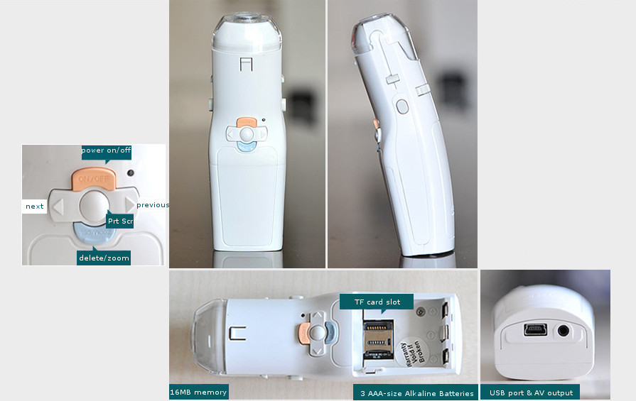 Video Output Full Digital Electronic Colposcope Gynecology Camera With User