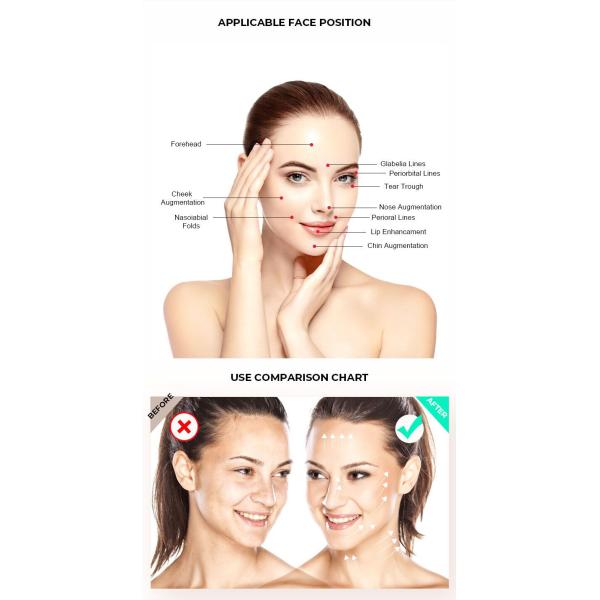 20g 130mm PDO PCL PLLA Threads 26G Facial Collagen Threading