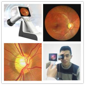 Wholesale Portable Handheld Wifi Digital Ophthalmoscope For Eye Fundus from china suppliers