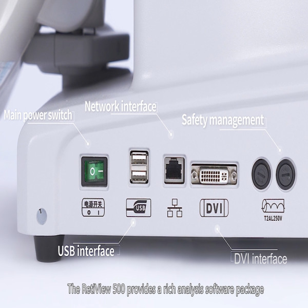 Oct Eye Coherence Tomography Machine 60 Hz For Clinic PC Inside No Complex Connection