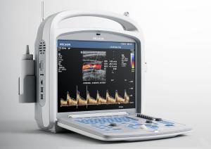 Wholesale PW Function Color Doppler Machine Trolley Untrasound Scanner With 18.5 Inch Color Touch Screen from china suppliers