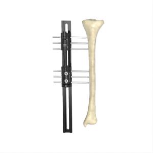 Limb Lengthening Monolateral External Fixator R Type Combined External Fixator ISO