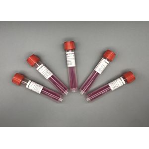 Buy cheap ISO13485 Class I Disposal Oral Throat Swab VTM Kit from wholesalers