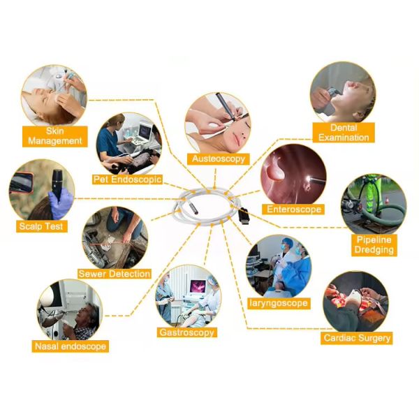 Mini Usb 1mm Industrial Endoscope Camera Module