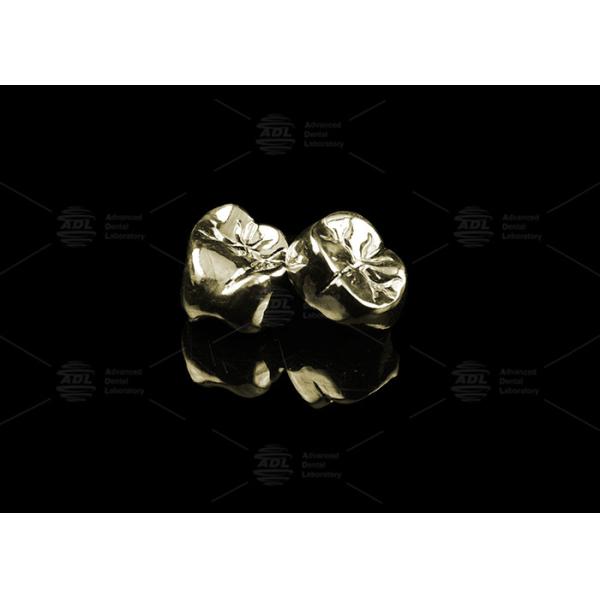 Sleek Full Cast Metal Crown Precious Alloy Gold 20% Polished Full Metal Dental