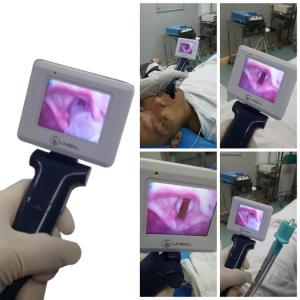 Wholesale Operating Portable Video Laryngoscope Using In Routine Endotracheal Intubation from china suppliers