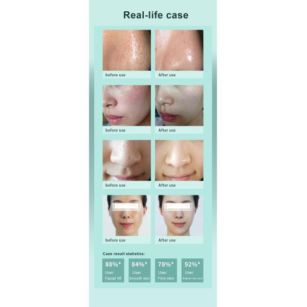 Multifunctional Hydrafacial Machine 8 In 1 Oxygen Machine For Skin Care