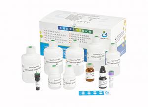 China Induced Sperm Acrosome Reaction Reagent Kit Accuracy Male Fertility Test Kit on sale
