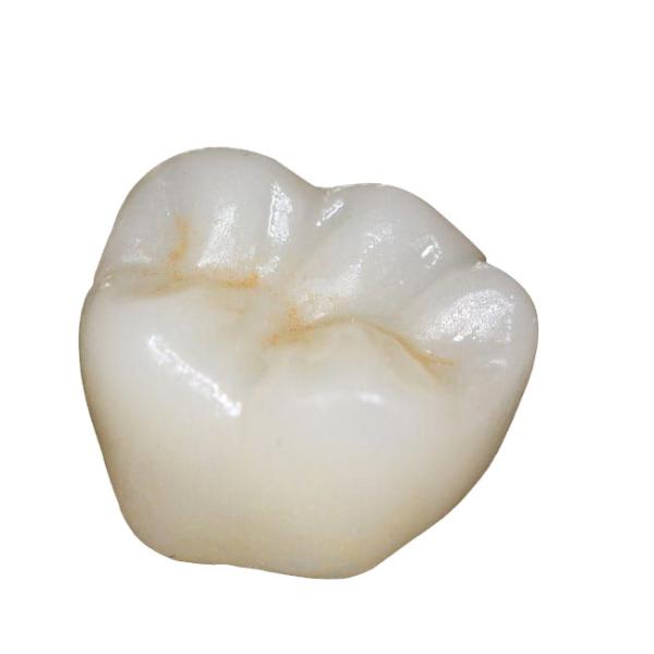 Quality ISO Zirconia Dental Crown Computer Numerical Control Processing Good Biocompatibility for sale