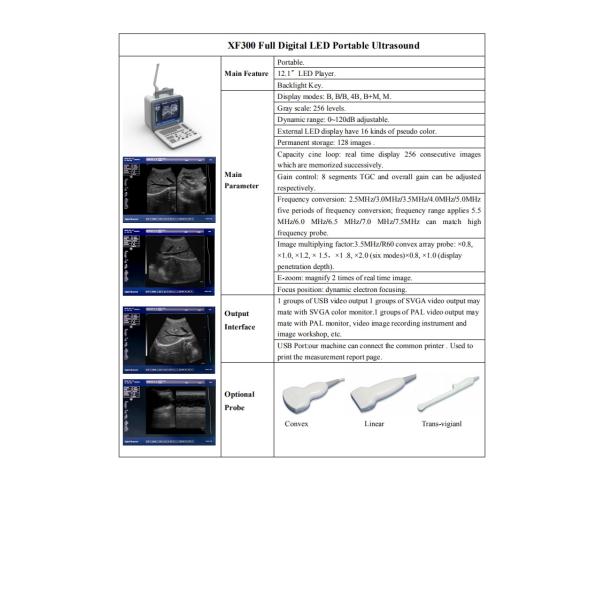 Full Digital OB GYN USG Scan Machine 0 To 120dB 12in Led Display