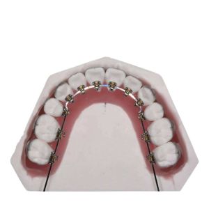 Wholesale Straight Wire Fixed Orthodontic Appliances For Teeth Straightening from china suppliers