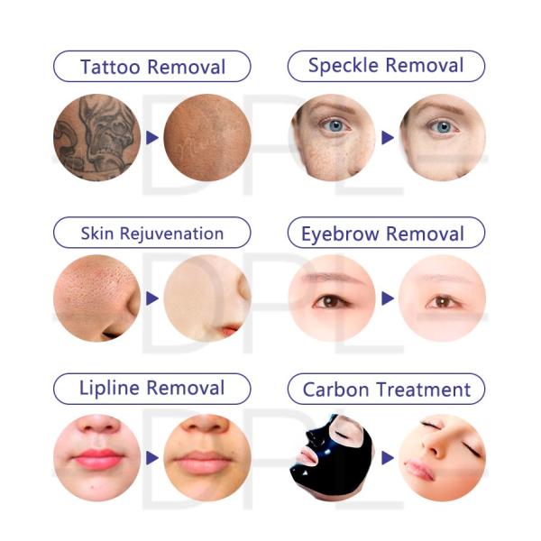 Portable Q Switch Nd Yag Picosecond Laser Beauty Acne Treatment machine