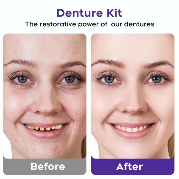 DIY Fake Teeth Repair Kit Missing Teeth Long Or Short Term Denture Solution
