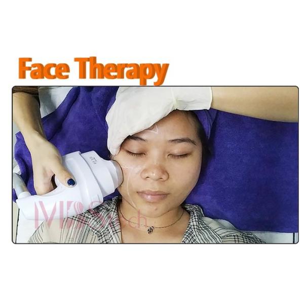 1000000 Shots 5 Cartridge ICE 5D Hifu Face Lift Machine