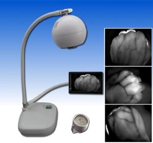 Version Instruments Infrared Vein Viewer Using Infrared Light Source