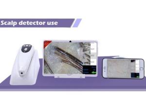 China Digital Microscope for Skin and Scalp Video Dermatoscope with 2 Million Pixels on sale