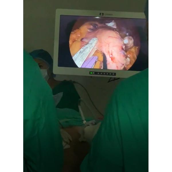 QELC6035B Laparoscopic Surgical Linear Cutting Stapler