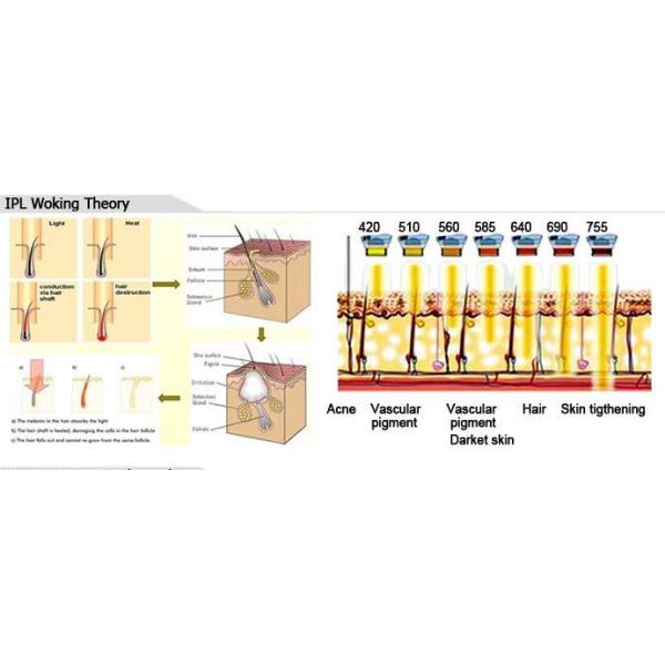 Multifunctional IPL Hair Removal Machines For Wrinkle / Age Pigment Removal