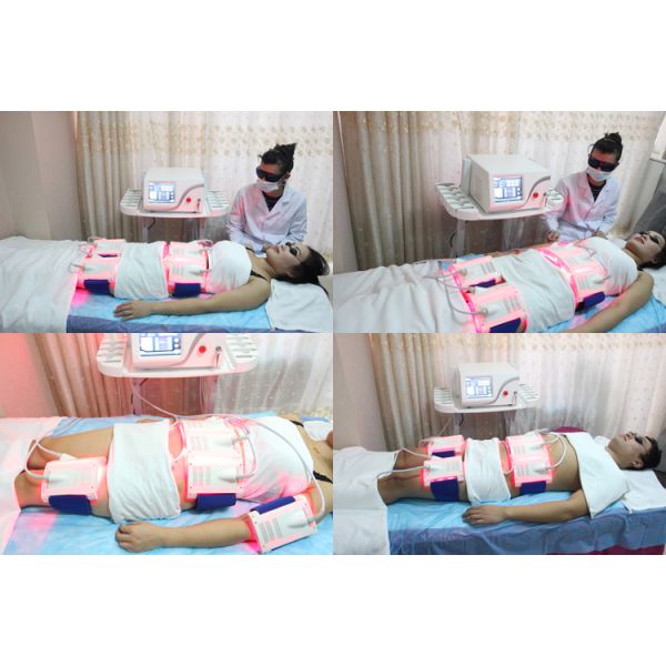 1000mw Lipo Laser Slimming Machine 650nm & 980nm User Friendly Designed