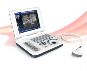 Diagnostic Laptop Ultrasound Machine Digital Ultrasound Scanner Durable