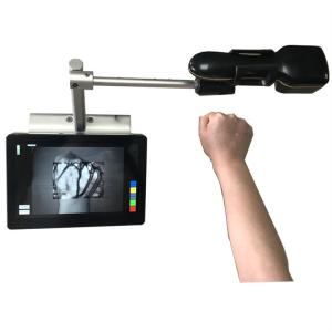 Wholesale No Radiation Clear And Accurate Infrared Vein Finder With 2 Million Pixels Infrared Camera from china suppliers