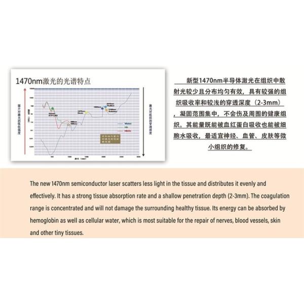 Hospital Vascular Removal Diode Laser 980 1470 Nm Hemorrhoid Machine