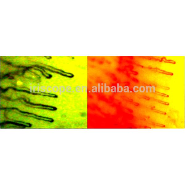 7 Inch Black LCD Capillary Nail Microcirculation LED Cold Light